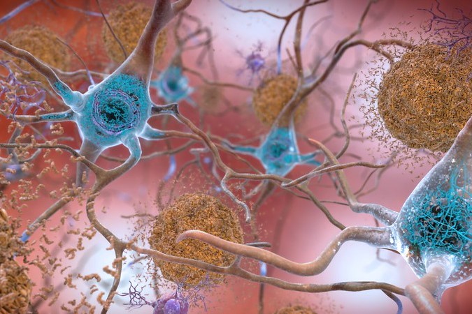 Eli Lilly Alzheimer's Drug Meets Phase 3 Goals, Teeing Up Plans for FDA Filing