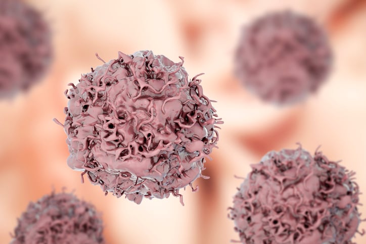 Precision Medicine Firm Caris Breaks Bio IPO Drought, Raising $494M for Cancer Analysis Tools