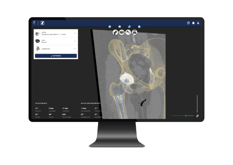 Formus Labs' Hip Surgery Planning Software Expands into the US with FDA Clearance