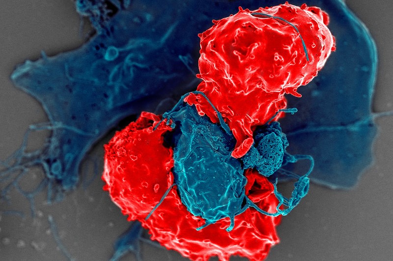 AstraZeneca Teams Up With Startup Quell in Type 1 Diabetes, IBD Cell Therapy Pact